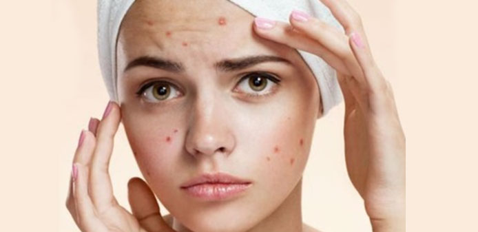 Acne Treatment Centre