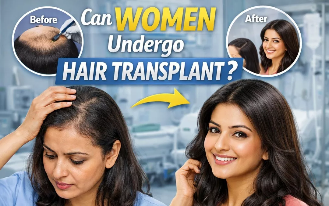 Can Women Undergo Hair Transplant?